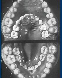 Tændernes anatomi